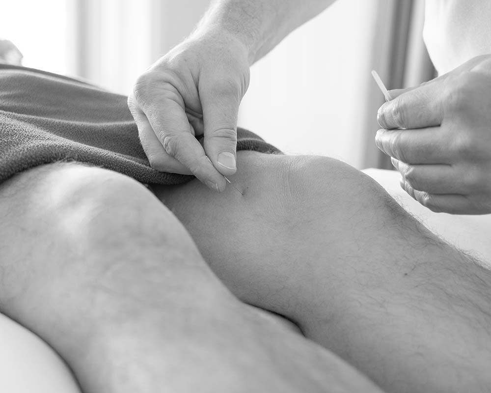 ACUPUNCTURE treatment on mans knee in greyscale
