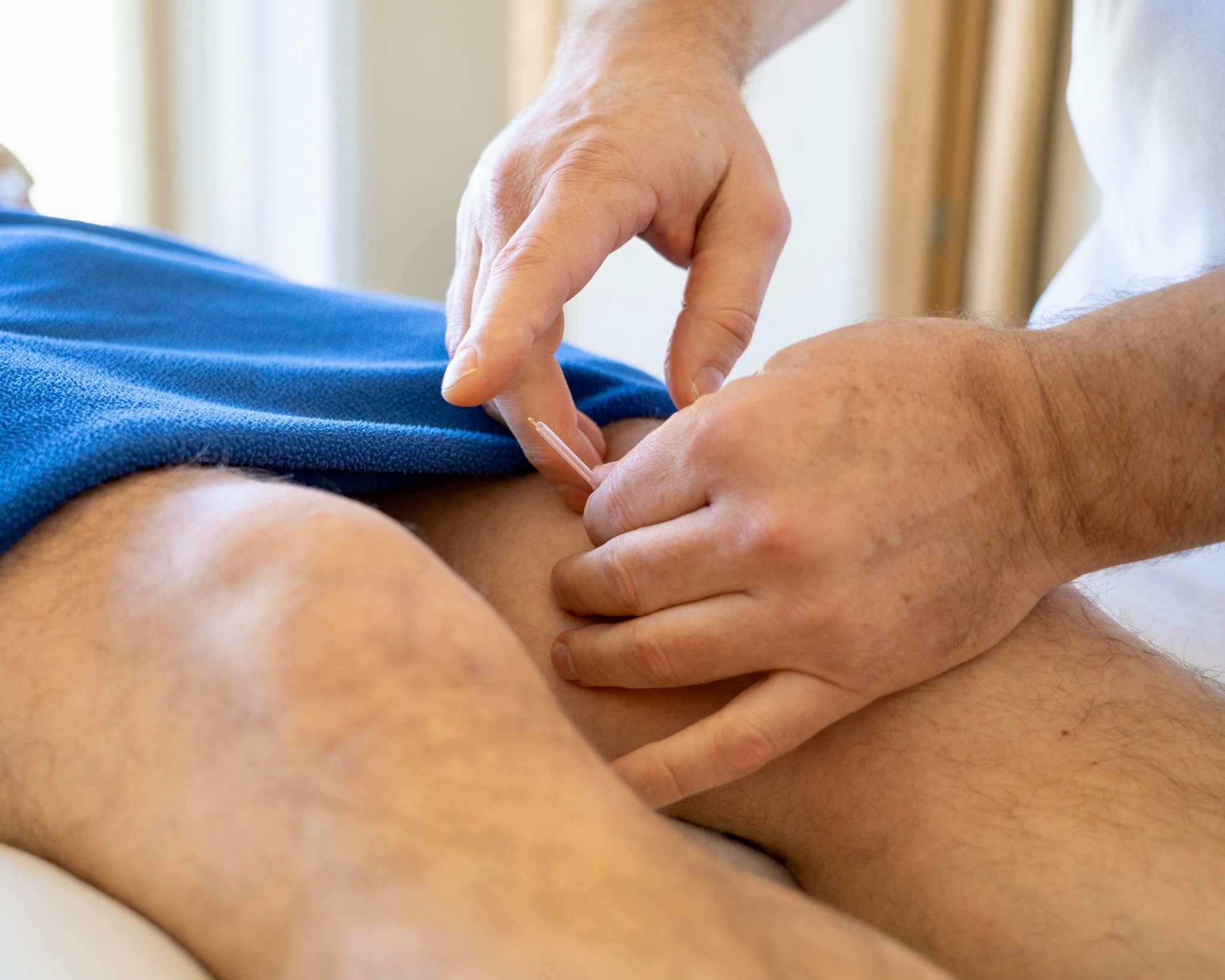 ACUPUNCTURE treatment on mans knee